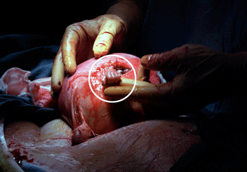 Samuel Armas grasping Dr. Joseph Bruner's finger.